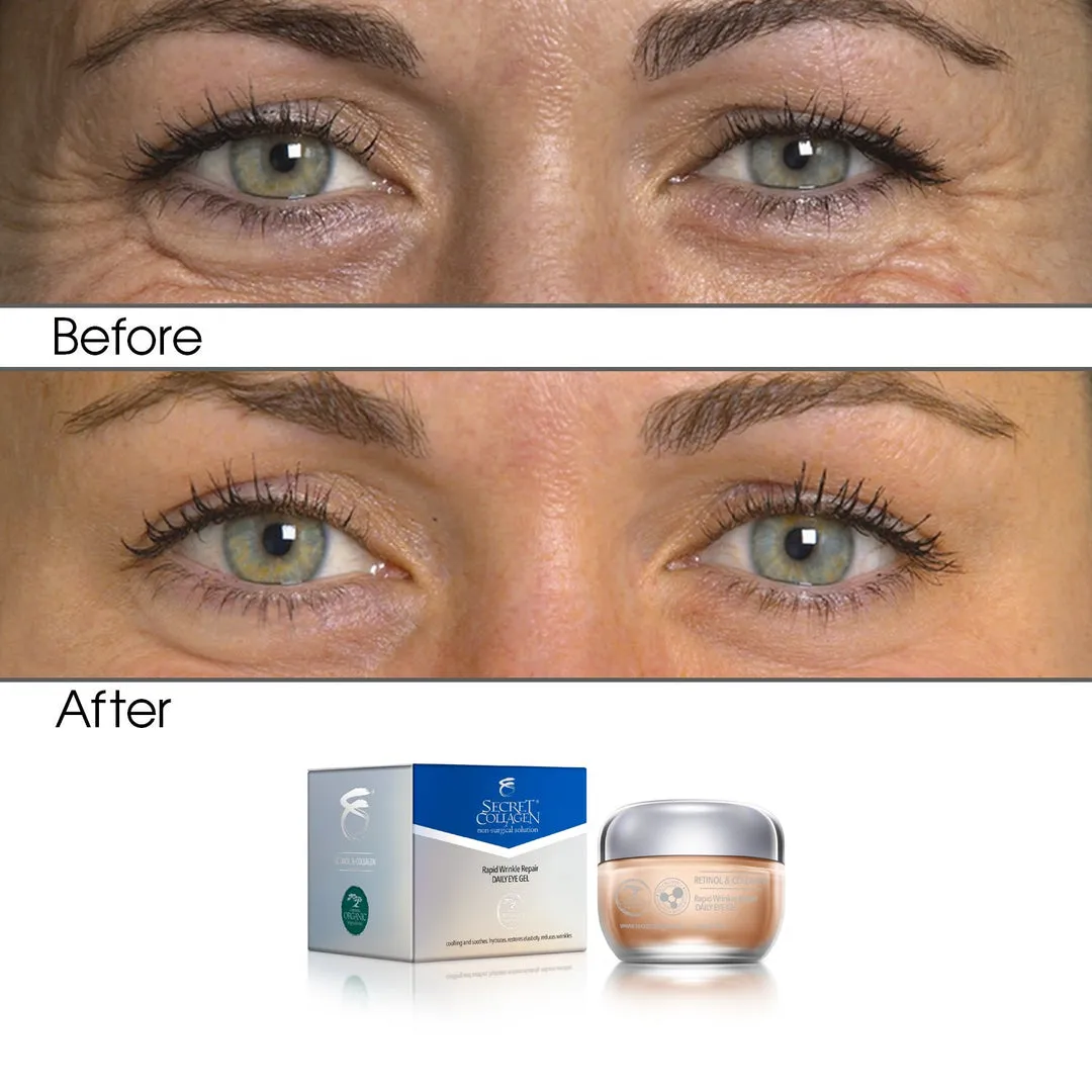 rapid wrinkle repair eye daily gel